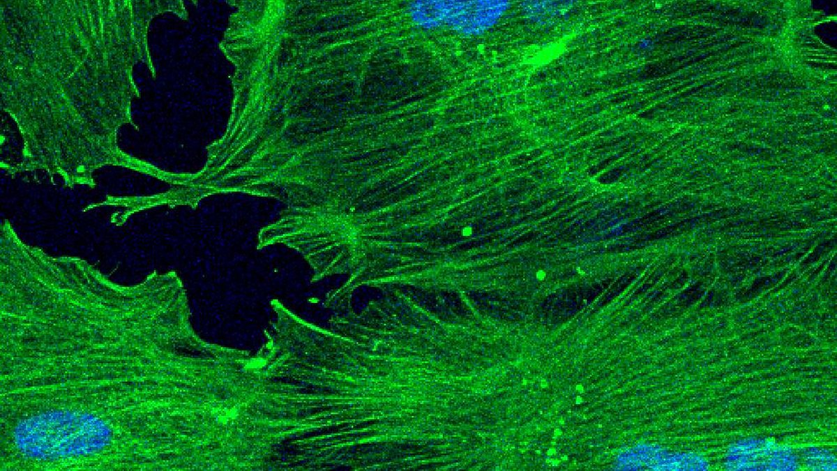 Fluorescence micrograph of cultured stem cells with green cytoskeleton and blue nuclei — illustrating urine-derived stem cells, a Panacea Bio Chem monograph by Bogdan Dicoias